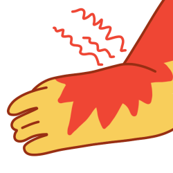 An arm with a red mark on most of it and red zigzags radiating from the area